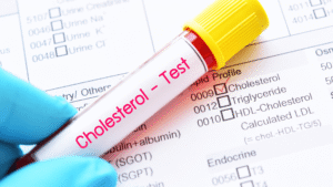 High Cholesterol Try These Effective Ayurvedic Treatments (kris gethin gyms blogs)
